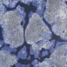 Bone formation by cultured rat osteoblasts; ALP stain (t.arnett@ucl.ac.uk)